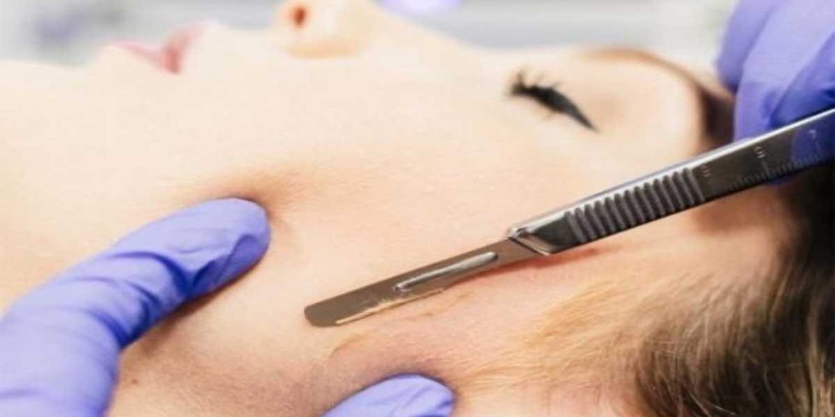 A person getting their face waxed with a scissor.