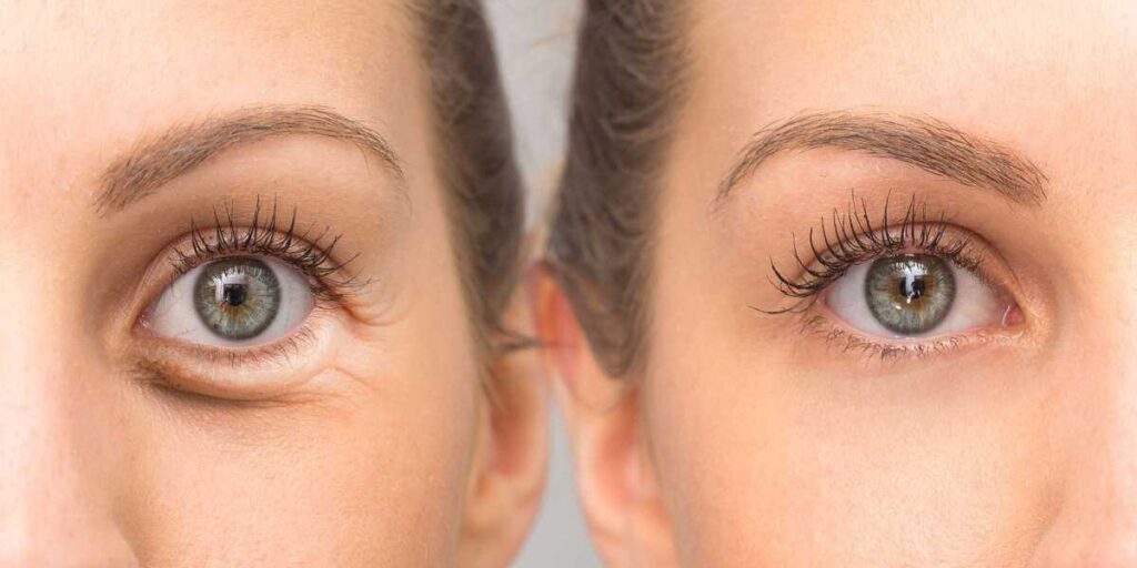 A woman with long eyelashes and an eye bag.