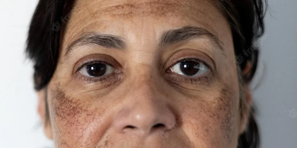 A close up of the eyes and face of an older person