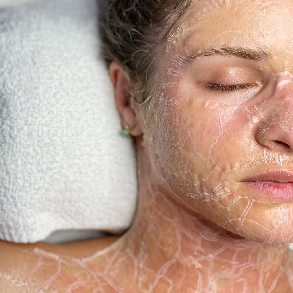 A woman with white lotion on her face.