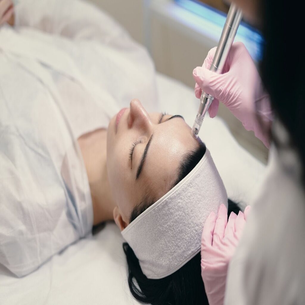 Los Angeles Microdermabrasion