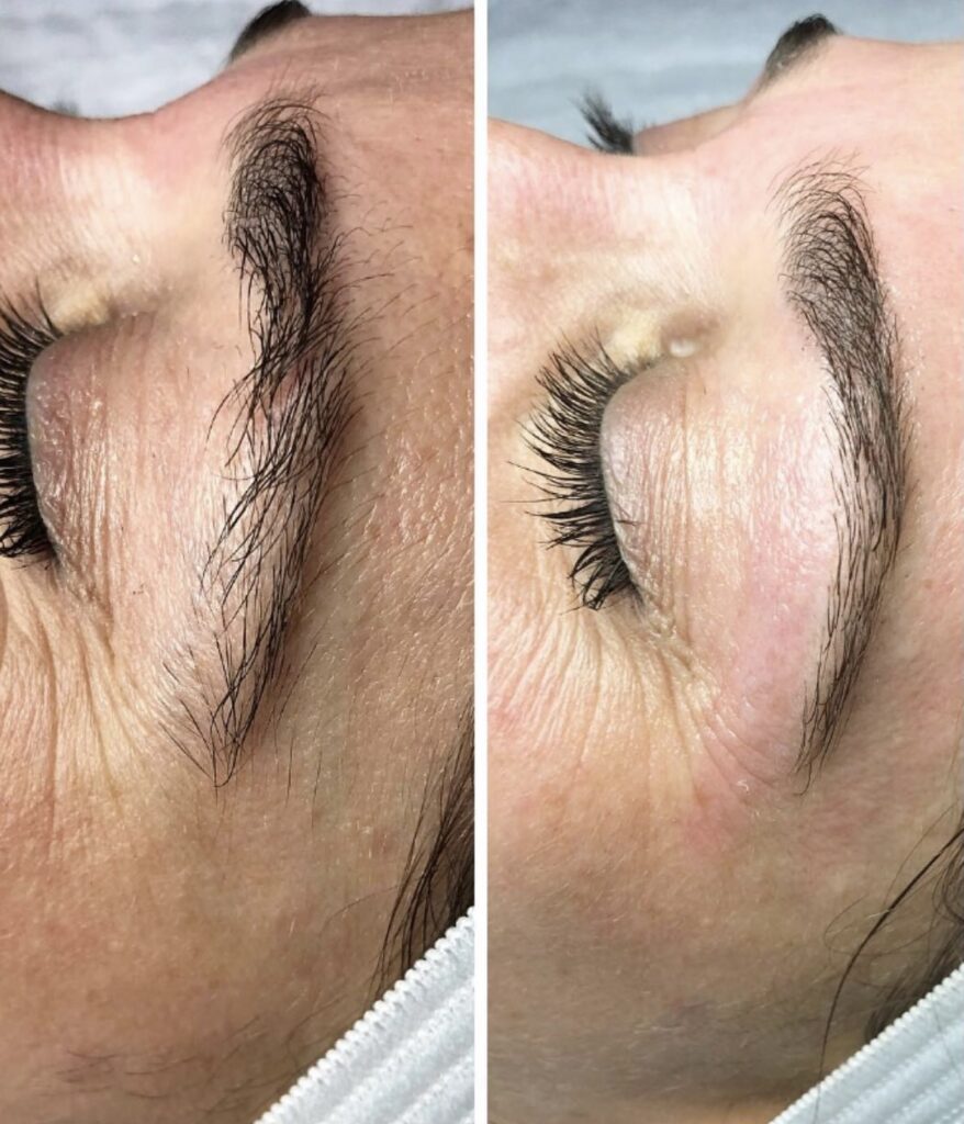 A before and after picture of the brows of a woman.