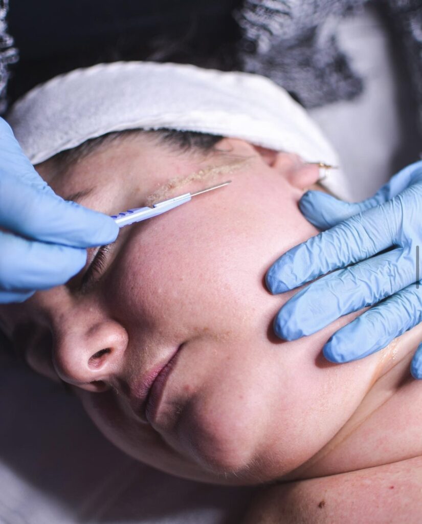A woman getting her eyebrows waxed by an esthetician.