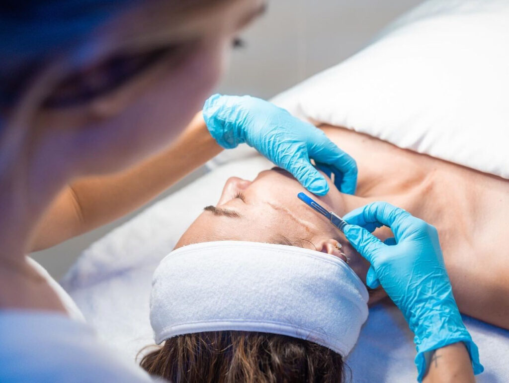 A woman is getting her face waxed by an esthetician.
