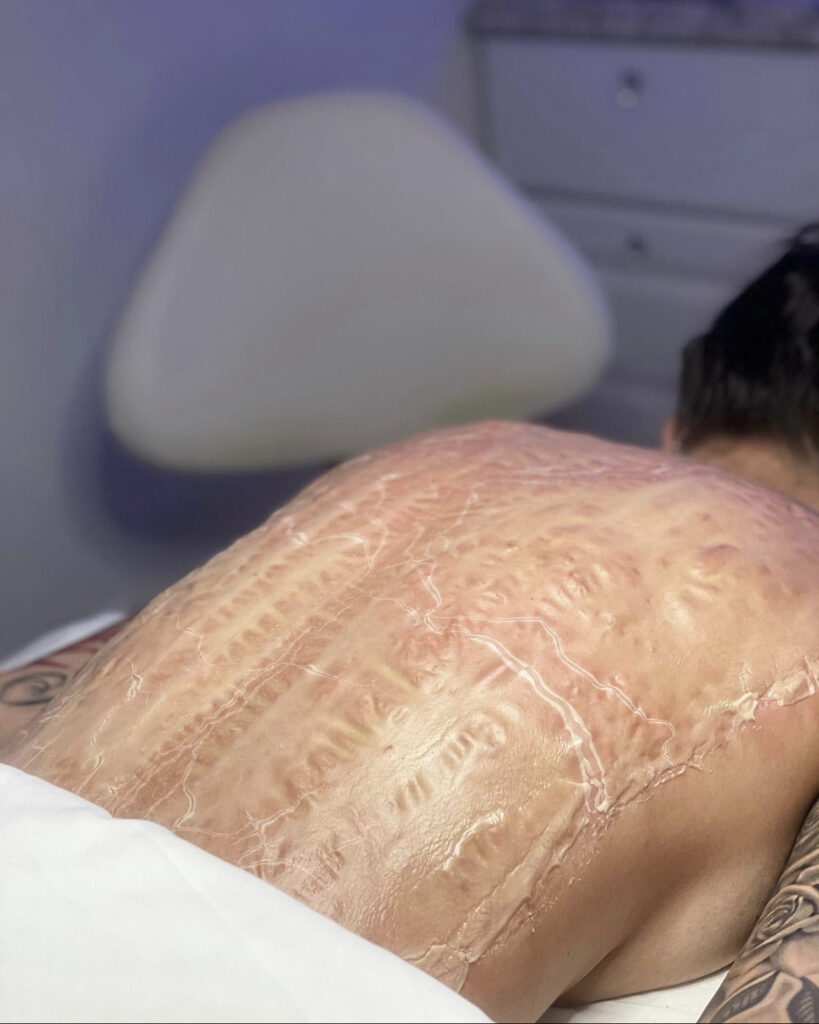 A man laying down with some white markings on his back
