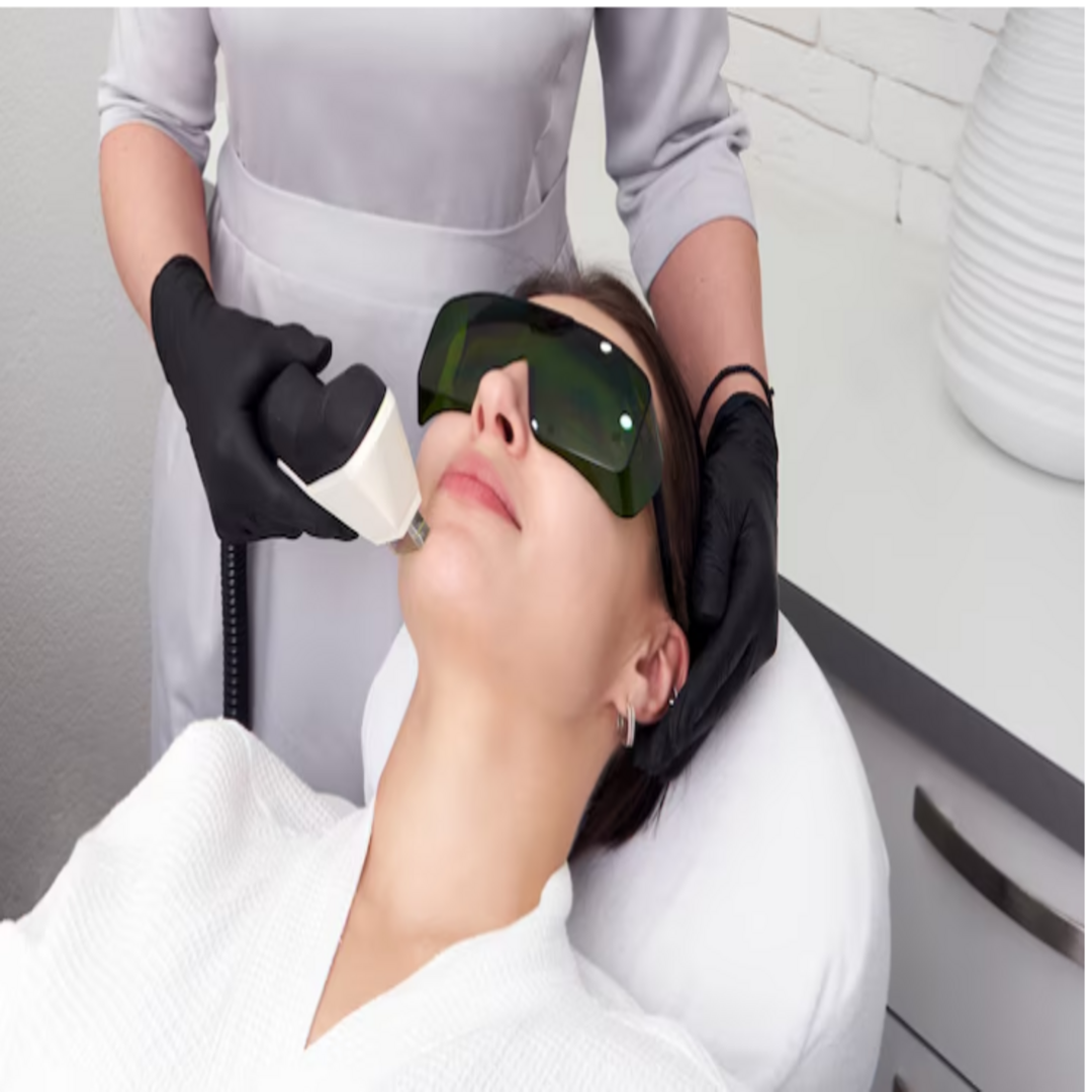 Los Angeles Laser Skin Resurfacing